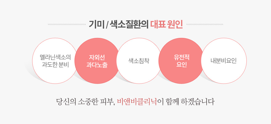 기미/ 색소질환의대표원인, 멜라닌색소의 과도한분비, 자외선과다노출, 색소침착, 유전적요인, 내분비요인